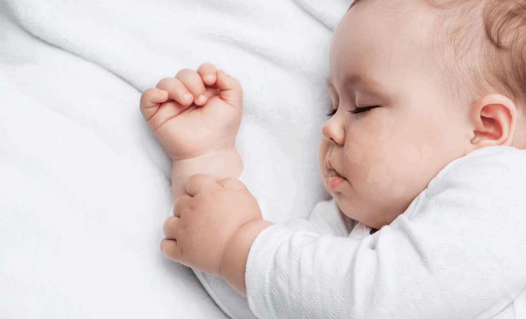 Cara Merawat Kulit Bayi