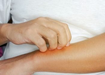 Kenali 5 Penyakit Gatal Di Kulit: Gejala, Penyebab, Cara Mengatasi